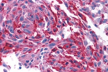 Anti-CRF1/CRHR1 antibody - N-terminal(AB230803)