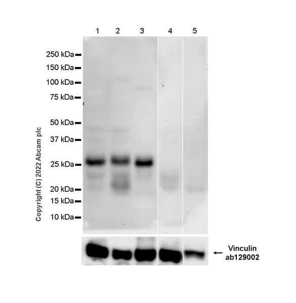 Bcl10 Antibody Ep605y Bsa And Azide Free Ab189218  Western Blot Img407637
