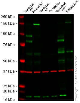 Anti-Desmoglein 2/DSG2 antibody [EPR6768] - Low endotoxin, Azide free(AB230833)