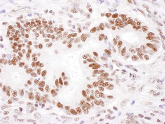 Pabpn1 Antibody Ab241477  Immunohistochemistry Formalin Pfa Fixed Paraffin Embedded Sections Img61825