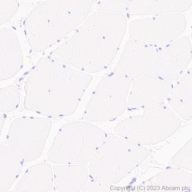 Anti-TMS1/ASC antibody [RM1049](AB309497)