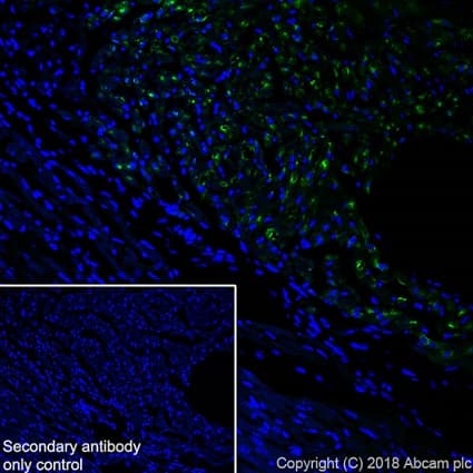 Natriuretic Peptides A Antibody Epr22089 283 Ab225844  Immunohistochemistry Frozen Sections Img132624