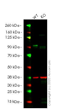 Anti-SUZ12 antibody [EPR5234(N)] - ChIP Grade(AB175187)