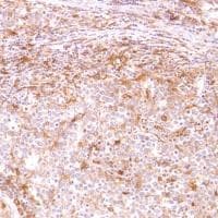 Anti-CD14 antibody [SP192](AB183322)