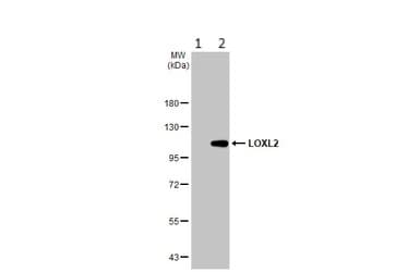 Loxl2 Antibody Ab96233  Western Blot Img445729