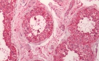 Anti-CRF1/CRHR1 antibody - N-terminal(AB230803)