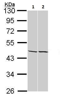 Anti-ADK antibody(AB227087)