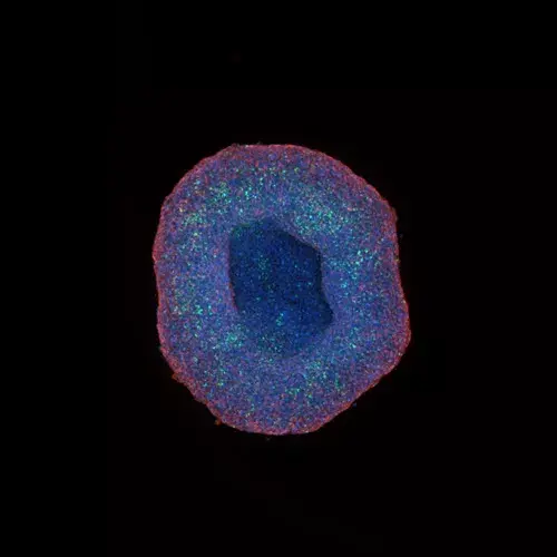 Hepg2 Spheroid Acquired At 10x Magnification