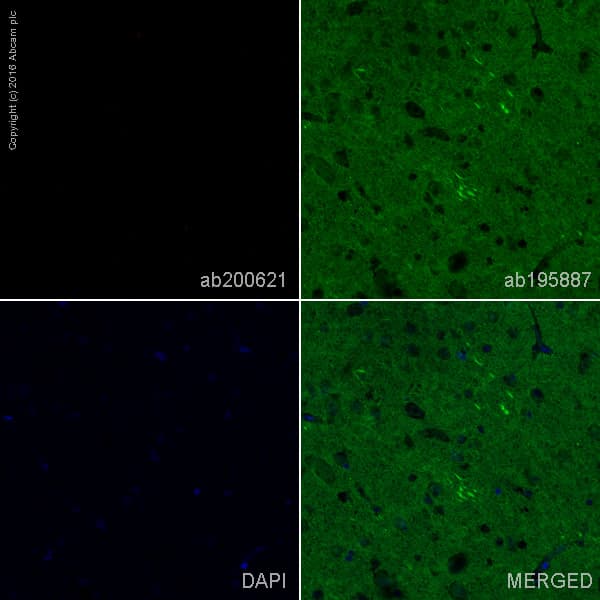 Rabbit Monoclonal H19 5 Human Kappa Light Chain Alexa Fluor 647 Ab200621  Immunohistochemistry Formalin Pfa Fixed Paraffin Embedded Sections Img72599