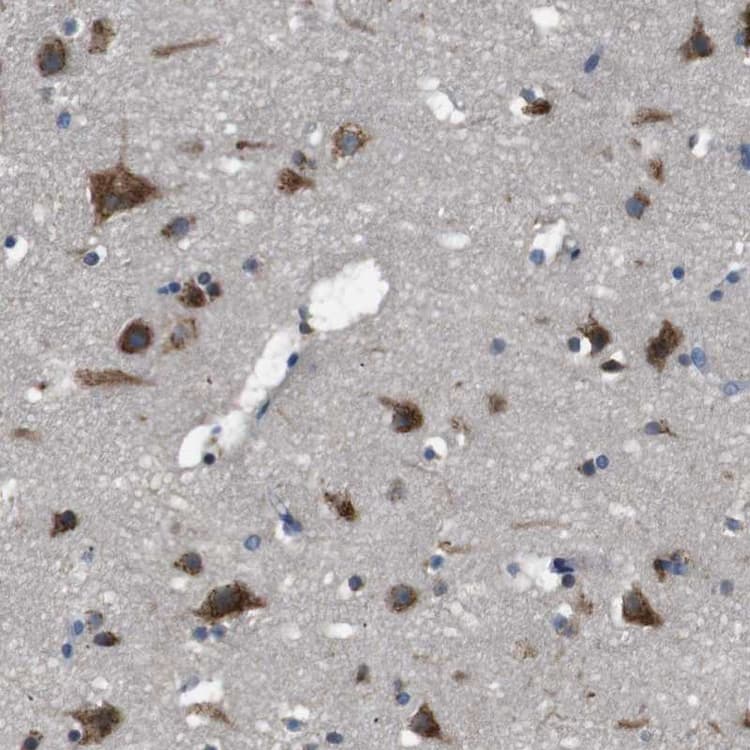 Anti-TMED2 antibody(ab251705)