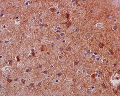 Anti-STAT3 antibody [EPR787Y](AB68153)