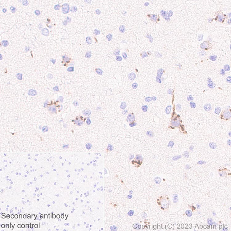 B4galnt1 Antibody Epr28064 64 Ab314130  Immunohistochemistry Formalin Pfa Fixed Paraffin Embedded Sections Img420037