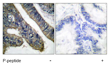 Cytosolic Phospholipase A2 Phospho S505 Antibody Ab53105  Immunohistochemistry Formalin Pfa Fixed Paraffin Embedded Sections Img117925