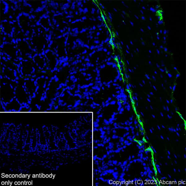Anti-LYVE1 antibody [RM1067](AB314241)