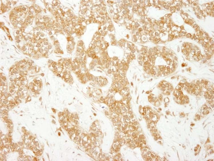 Eea1 Antibody Ab264245  Immunohistochemistry Formalin Pfa Fixed Paraffin Embedded Sections Img134274