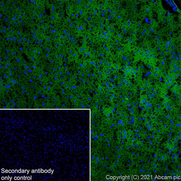 Anti-KCC2 antibody [EPR24203-85](AB259969)