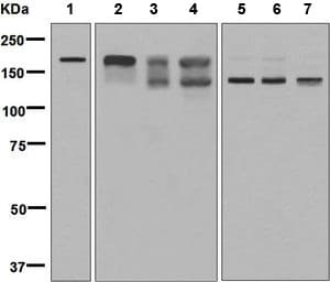 Clip170 Antibody Epr5093 Bsa And Azide Free Ab248720  Western Blot Img99471