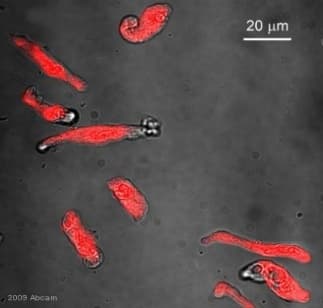 Anti-Vimentin antibody(AB24525)