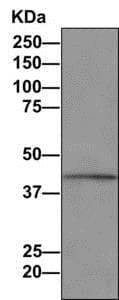 Anti-PTDSS1 antibody [EPR8118(2)](AB157222)