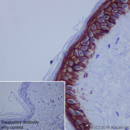 Trop2 Antibody Epr20043 Ab214488 Immunohistochemistry Formalin Pfa Fixed Paraffin Embedded Sections Img124895