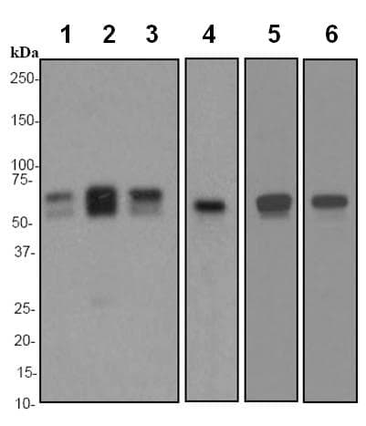 Anti-Calreticulin antibody [EPR3924] - ER Marker(AB92516)