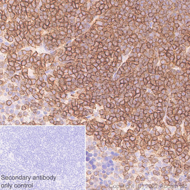 Semaphorin 4d Cd100 Antibody 30 Cd100 Ab307685  Immunohistochemistry Formalin Pfa Fixed Paraffin Embedded Sections Img408441