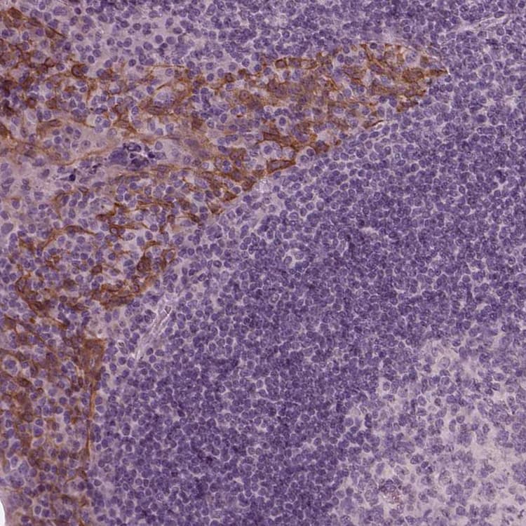 Krt79 Antibody Ab254953  Immunohistochemistry Formalin Pfa Fixed Paraffin Embedded Sections Img122724