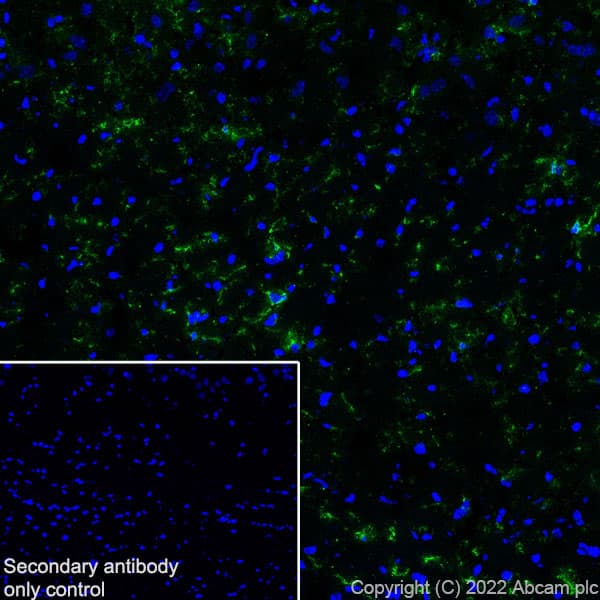 Anti-P2Y12 antibody [EPR26298-93](AB300140)