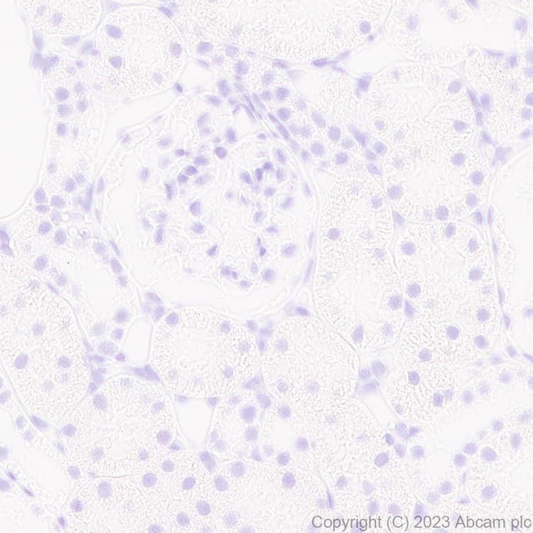 Anti-RFP antibody [EPR28246-45](AB314225)