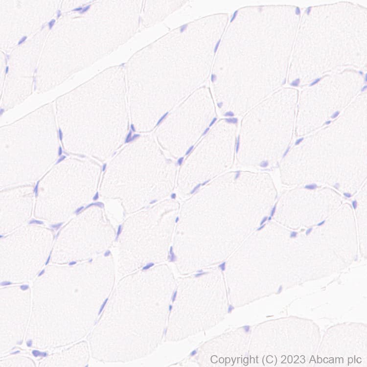 Anti-VSV-G tag antibody [EPR28362-204](AB309106)