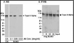 Anti-Topoisomerase II alpha antibody(AB12318)