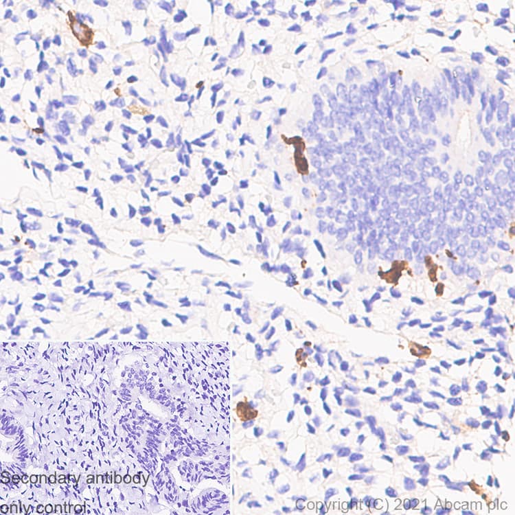 Anti-Iba1 antibody [EPR16589] - Rat IgG2a (Chimeric)(AB283346)