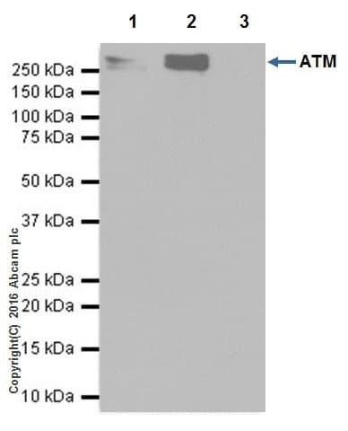 Anti-ATM antibody [EPR20100] - ChIP Grade(AB201022)