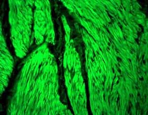 Anti-ACTC1 antibody [EP184E](AB46805)