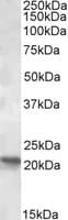 Rpb7 Antibody Ab93352  Western Blot Img53594
