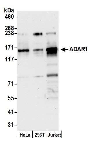 Anti-ADAR1 antibody(AB168809)