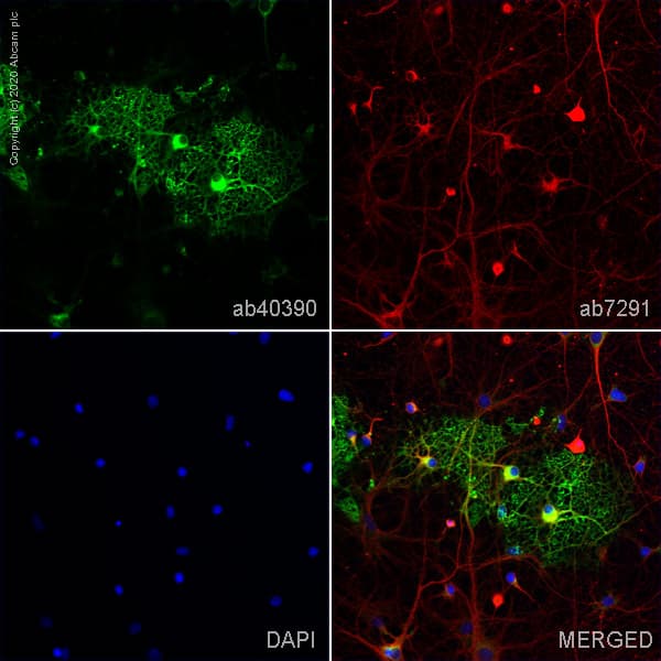 Anti-Myelin Basic Protein antibody(AB40390)