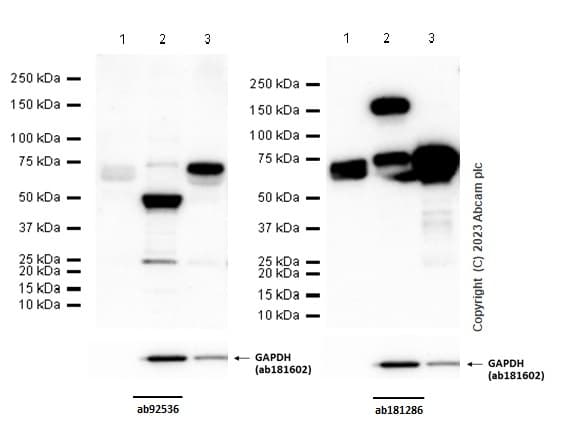 Anti-MMP2 antibody [EPR1184](AB92536)
