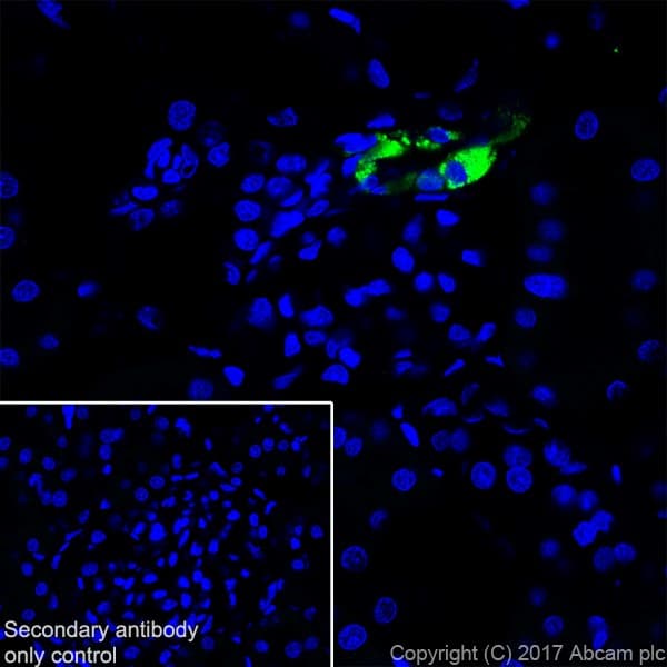 Anti-Renin antibody [EPR20693](AB212197)