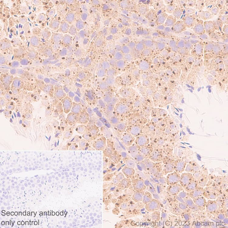 Fyco1 Antibody Epr28361 79 Bsa And Azide Free Ab316013  Immunohistochemistry Formalin Pfa Fixed Paraffin Embedded Sections Img426122