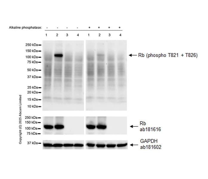 Anti-Rb antibody [EPR17512](AB181616)