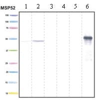 Anti-PDK4 antibody [1C2BG5](AB110336)