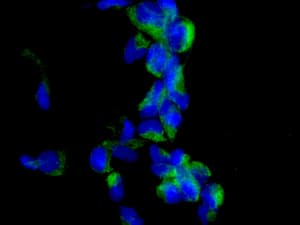 Nudt19 Antibody Epr13162 106 Ab180167  Immunocytochemistry Immunofluorescence Img95090