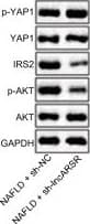 Anti-active YAP1 antibody [EPR19812](AB205270)