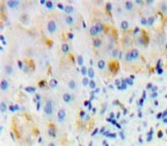 Osmr Antibody Ab232684  Immunohistochemistry Formalin Pfa Fixed Paraffin Embedded Sections Img107926