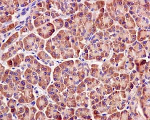 Git1 Antibody Epr10368 Ab171956  Immunohistochemistry Formalin Pfa Fixed Paraffin Embedded Sections Img115564