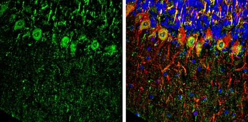 Anti-PHD2 / prolyl hydroxylase antibody - C-terminal(AB226890)