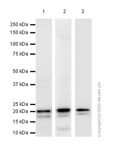 Anti-Ferritin heavy chain antibody [EPR3004Y](ab75973)