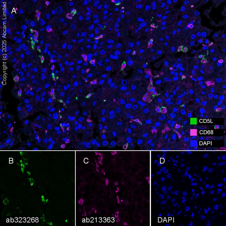 Anti-CD68 antibody [EPR20545](AB213363)
