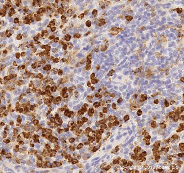 Macrophage Polarization Panel - Human IHC(ab278180)